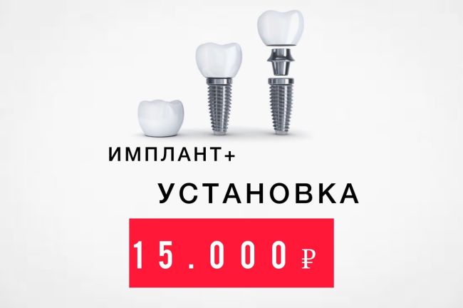 Сеть Стоматологий Эмидент • 5 филиалов в Уфе • 8-967-777-00-11 
Бесплатно=Консультация врача + Снимок всех зубов..