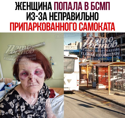 🚑 Женщина попала в БСМП из-за неправильно припаркованного самоката - он был брошен на остановке Космонатов..