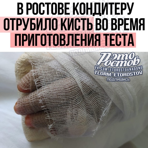 😨🚑 В Ростове кондитеру отрубило кисть во время приготовления теста  Хирурги-травматологи ГБСМП спасли..