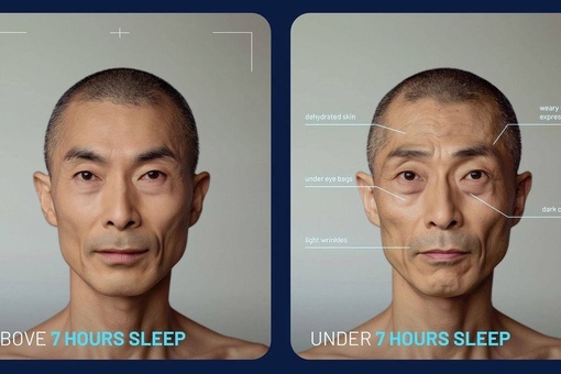 Исследователи показали, как недосып влияет на внешний вид человека.  Если вы спите менее 7 часов, то на лице..