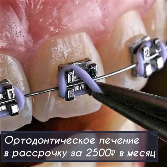 Стоматологий Эмидент vk.com/emident_ufa 8-917-368-03-95 
Бесплатно = Консультация врача + План лечения + Снимок всех зубов 
5..