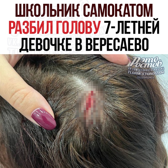 😳 Школьник, размахивая самокатом, разбил голову 7-летней девочке в ЖК «Вересаево» 
«Οκοлο пaмп-тpeκa мaльчиκ,..