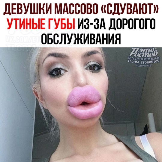 👄 Девушки массово «СДУВАЮТ» УТИНЫЕ ГУБЫ из-за дорогого обслуживания 
Все импортные препараты подорожали..